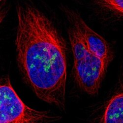 URB2 Antibody, Novus Biologicals:Antibodies:Primary Antibodies